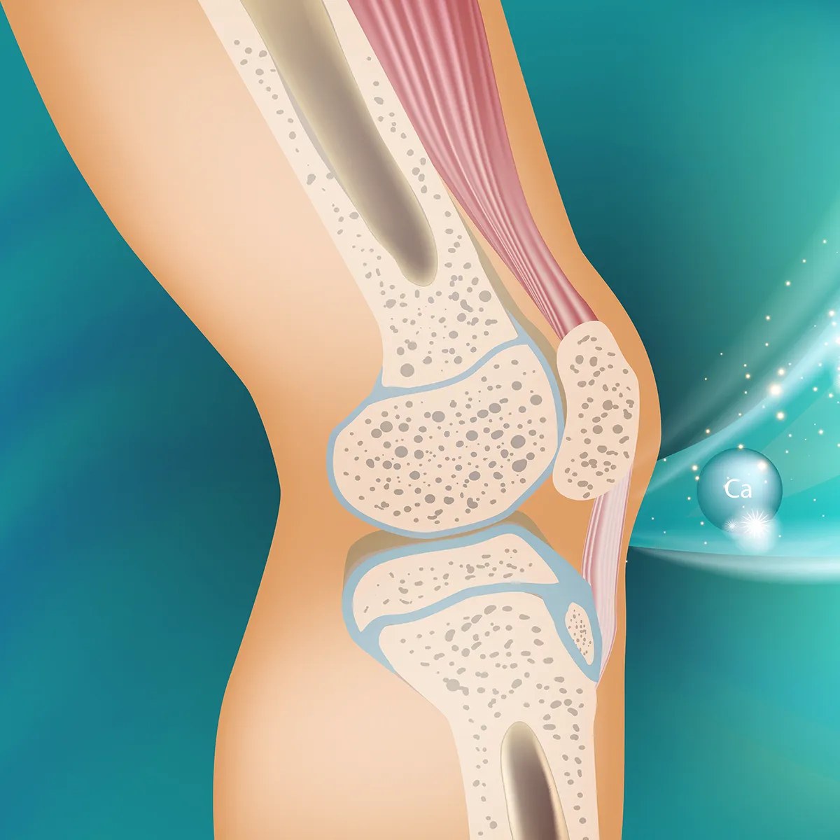 Schemadarstellung des Kniegelenkes mit Kalzium davor